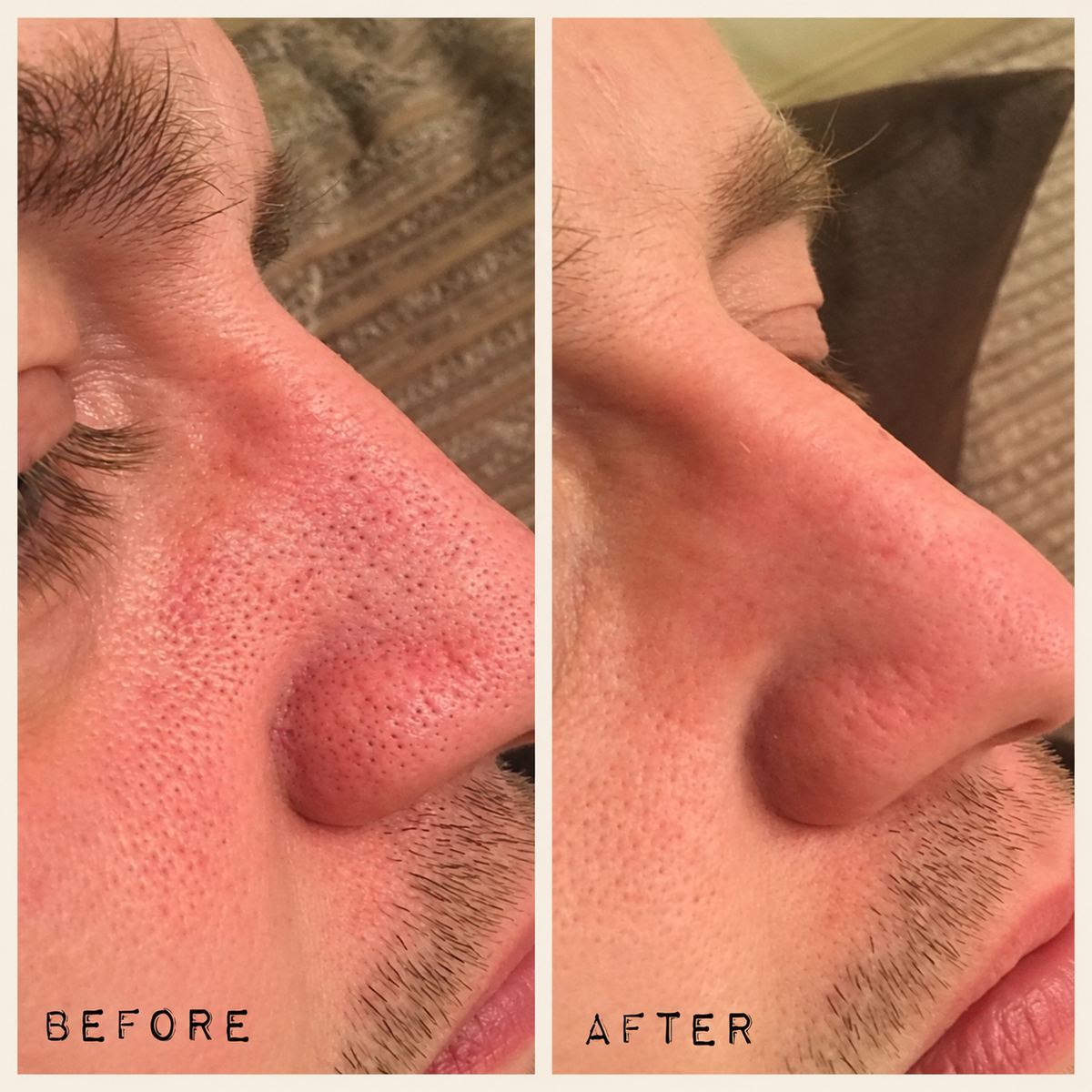 Luvanty Peel Shot Glow Rice Duo