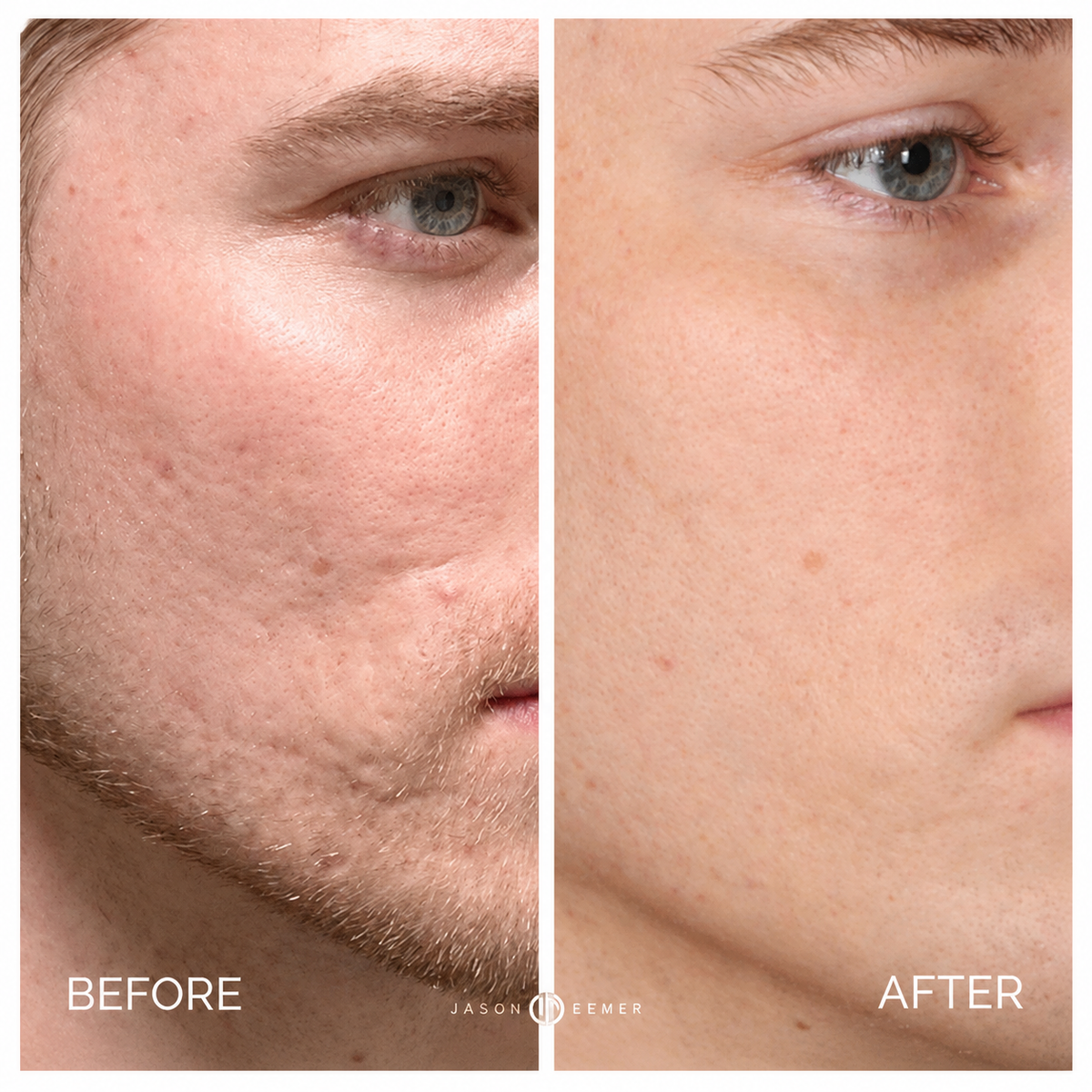Luvanty Peel Shot Glow Rice Duo