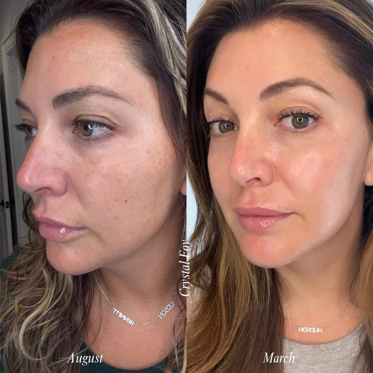 Luvanty Peel Shot Glow Rice Duo